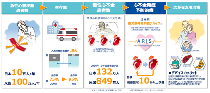 “電気的自律神経刺激”を用いた心筋梗塞領域縮小システムARiS